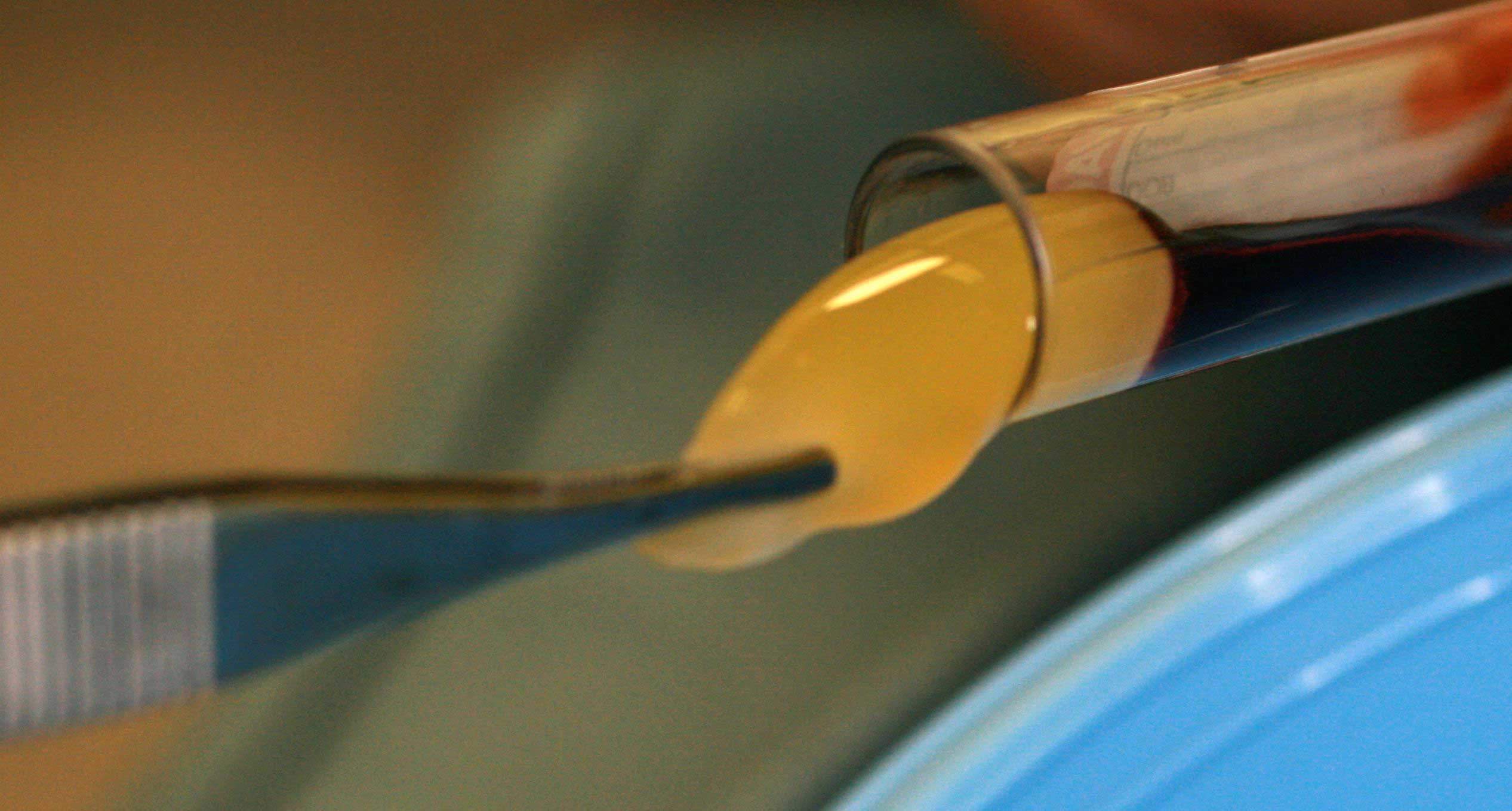 Clean Prf A-PRF and I-PRF - Perfect Smile Dentistry | Dr. Tamás Balsai